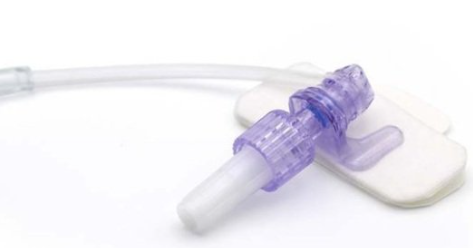 NP Medical's nCompass IV Catheter