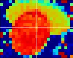 IRMA MATRIX APC system