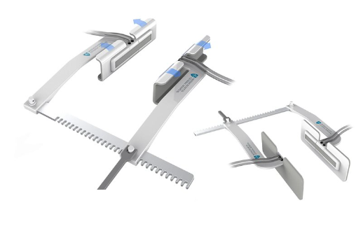 Vacuum-Assisted Sternotomy Retractor