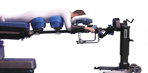 Allen® Spine System