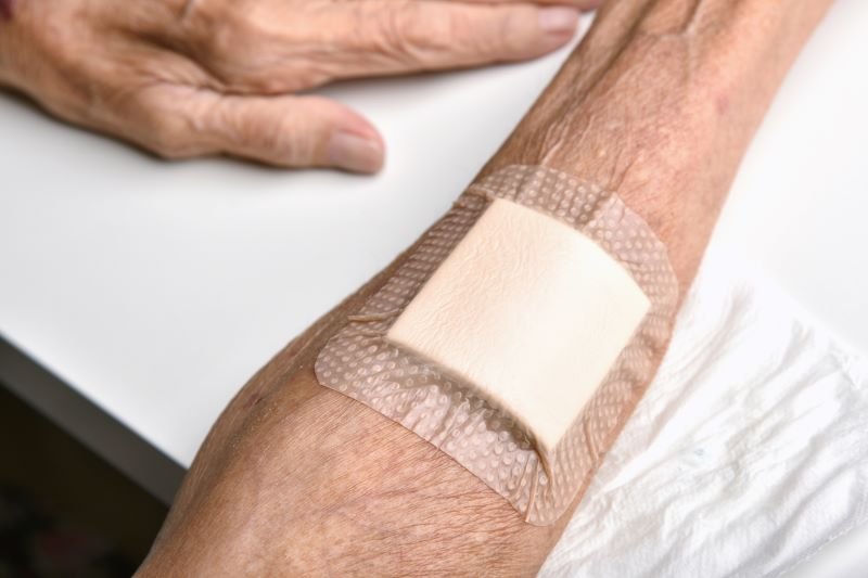 Die Cut Components for Wound Care Applications