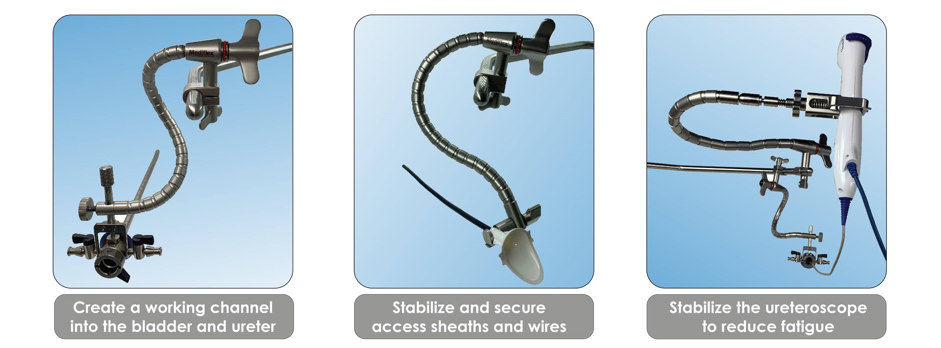 CystoAssist™